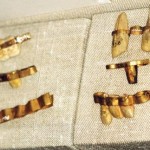 Дентални операции в древен египет